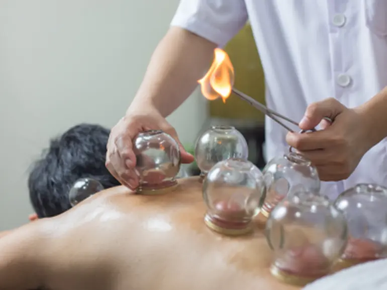 Gua Sha & Cupping