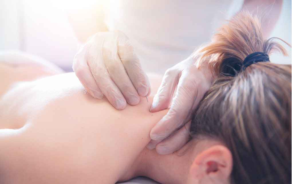 Does acupuncture help with anxiety? A Toronto TCM perspective.