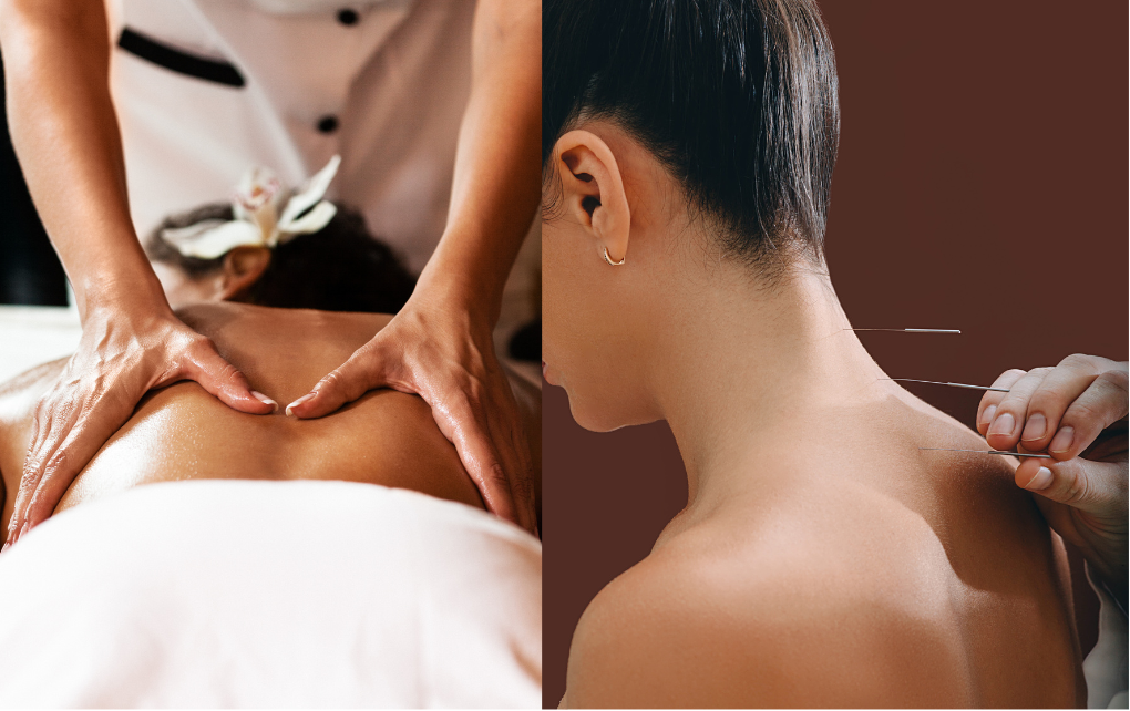 Acupuncture vs massage for stress relief—which is right for you?